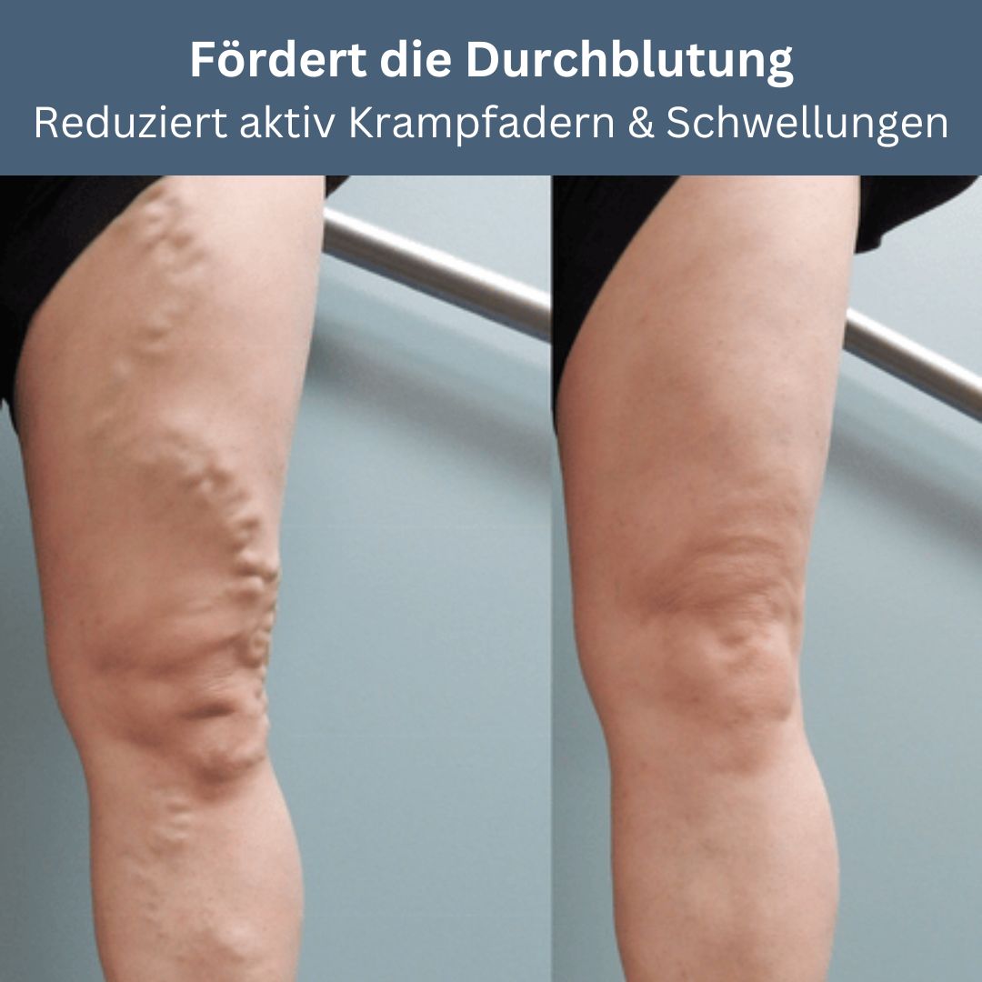 ActiveKnee - Innovative Kniebandage für wohltuende Erholung