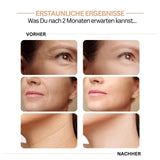 Rejuvena - Innovatives Massagegerät für straffe und schöne Haut